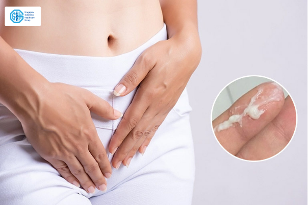 Khí hư như thế nào mà bất thường