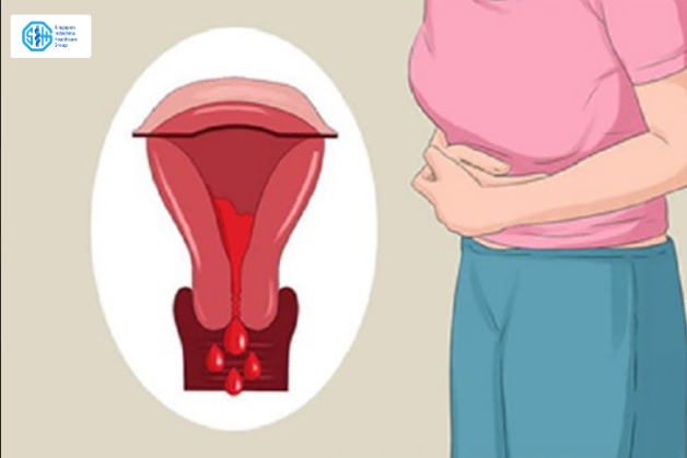 Rong kinh kéo dài 2 tuần là gì?