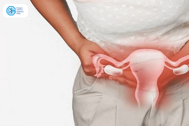 Dấu hiệu viêm âm đạo cấp tính