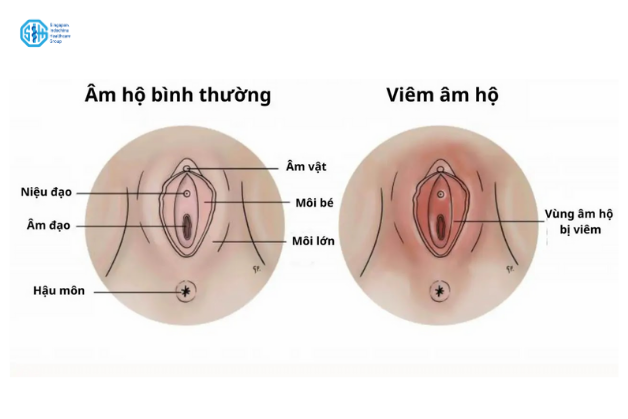 cau-truc-am-ho-nu.png