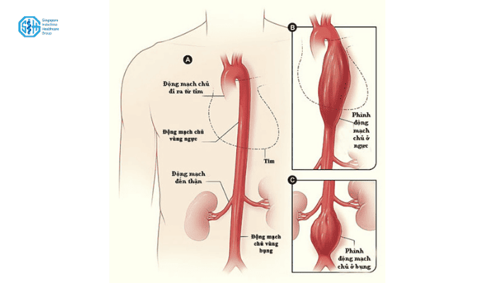 co-that-mach-vanh (2).png