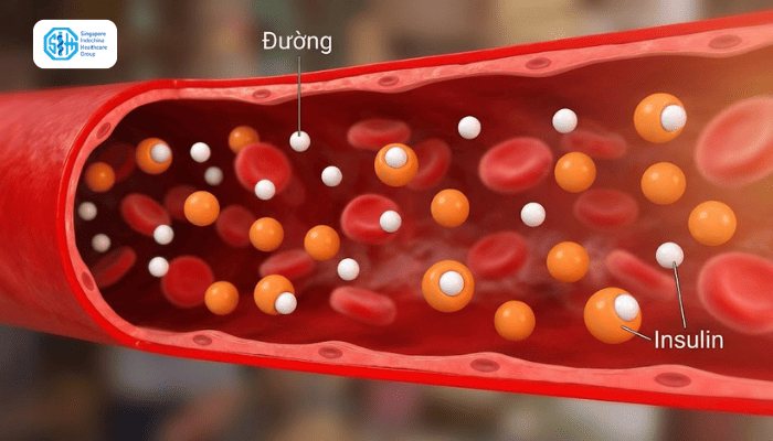 tieu-duong-type-2.png
