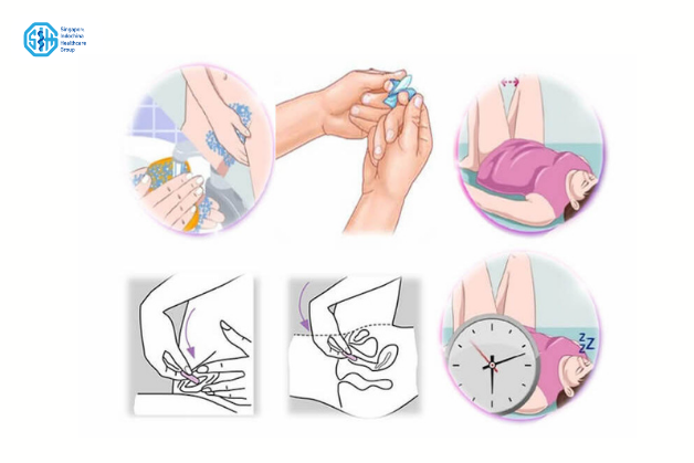 Bác sĩ hướng dẫn cách đặt thuốc phụ khoa tại SIHG