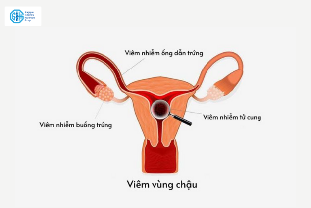 viem-vung-chau.png
