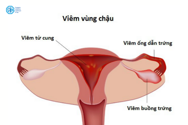 viem-vung-chau.png