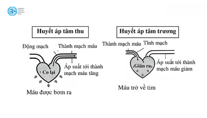 Minh hoạ huyết áp là gì