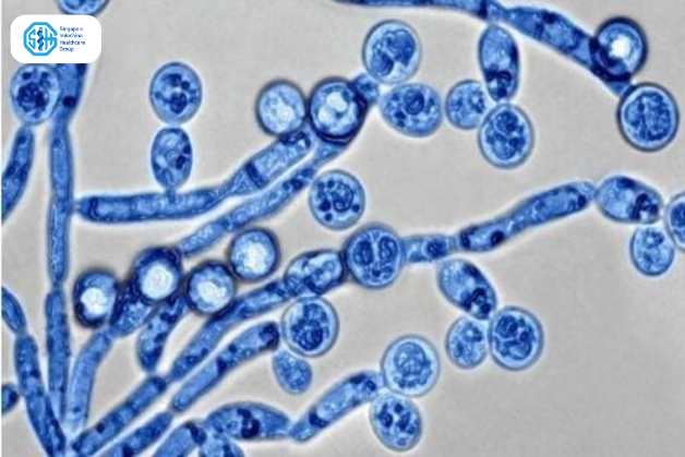 Nấm Candida soi dưới kính hiển vi