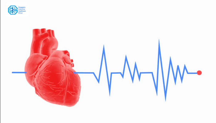 rối loạn nhịp tim là gì?