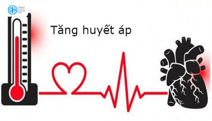 Bệnh cao huyết áp là gì