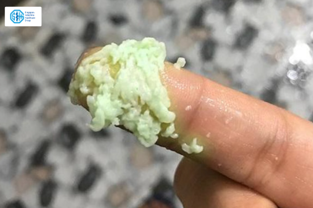 khi-hu-von-cuc-nam-candida.png