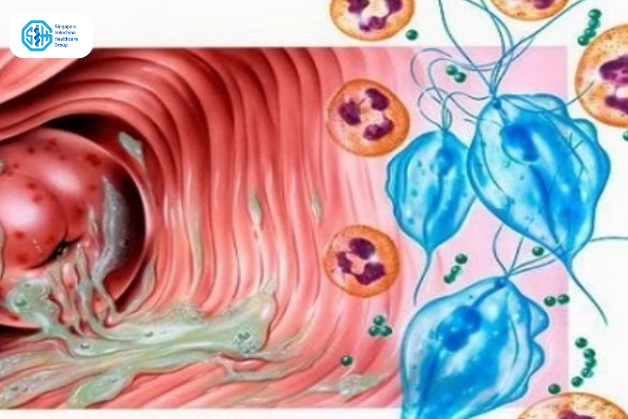 Đặc điểm Trichomonas vaginalis