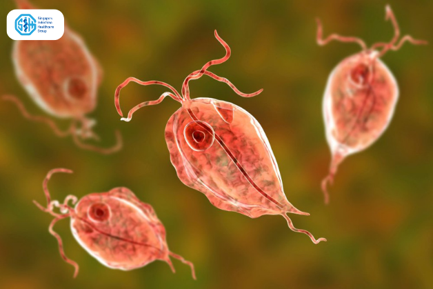 Nhiễm trichomonas