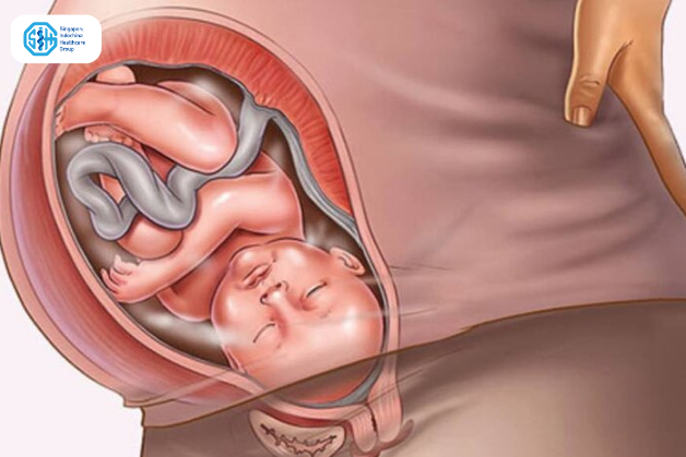 viêm âm đạo ảnh hưởng đến thai nhi như thế nào