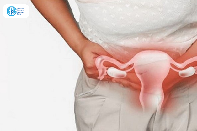 Triệu chứng của viêm phần phụ